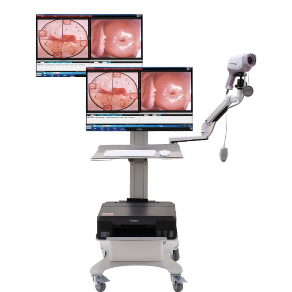 カーネルCE ISO 4K対応HDデジタルコルポスコープマシ - Women'S Health & Wellness Center のレビューと価格
